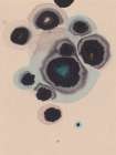 Study NAd10 | Living Stones Art Print